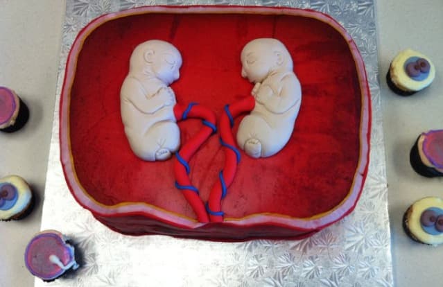 identical twin womb cake