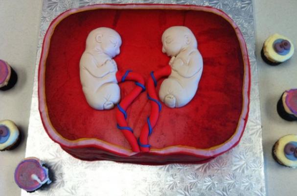 identical twin womb cake