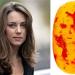 Man Finds Kate Middleton's Face in Jellybean
